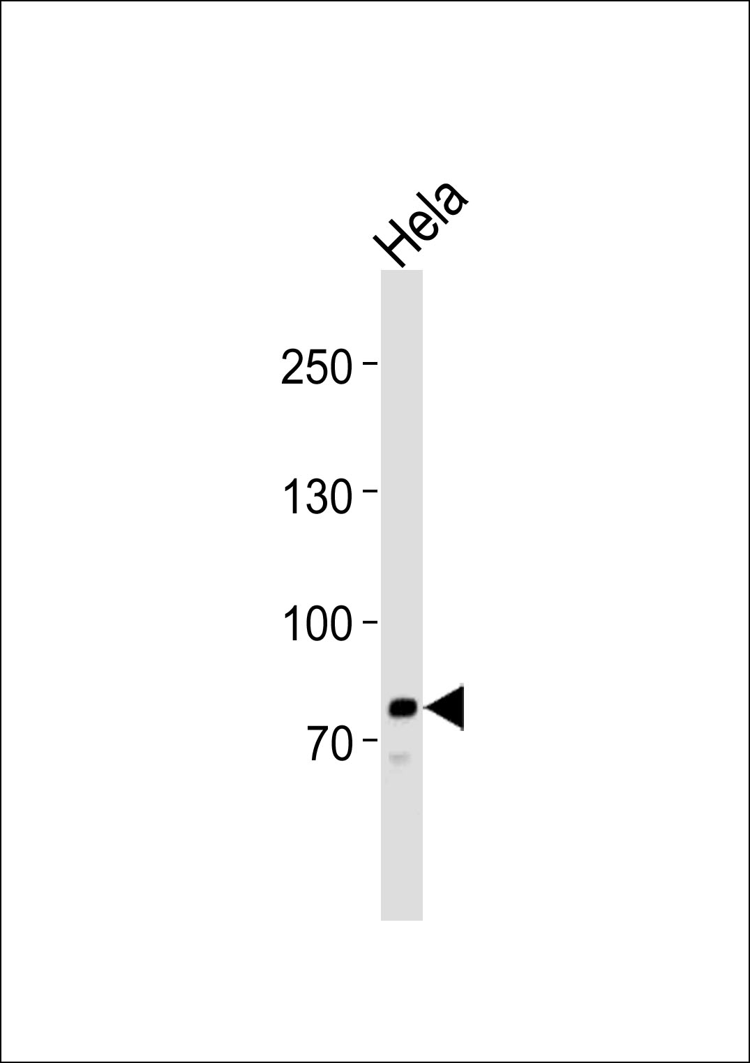 WB - PCSK9 Antibody (C-term) AP7333b